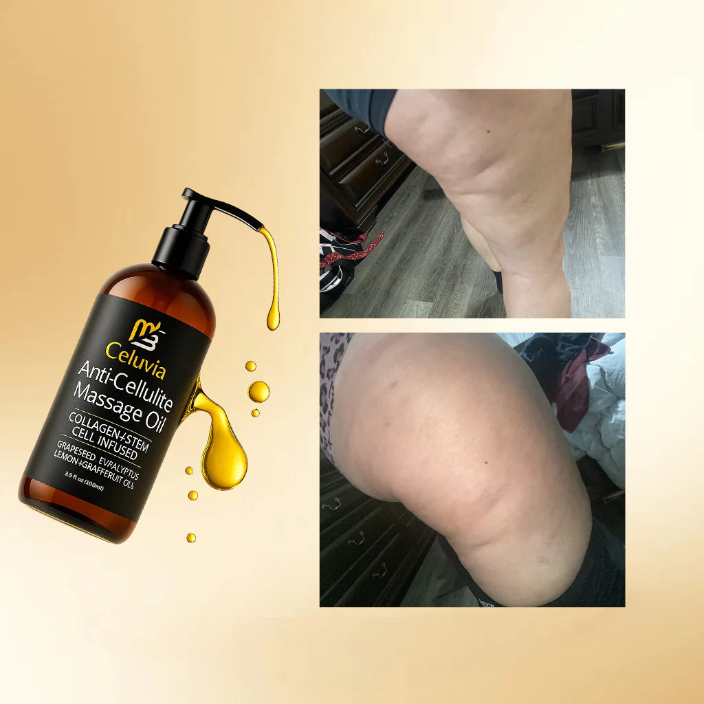 Celuvia™ - Aceite Anticelulitis Reafirmante