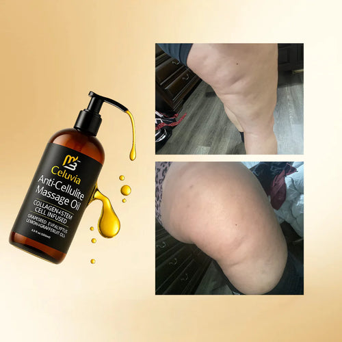 Celuvia™ - Aceite Anticelulitis Reafirmante